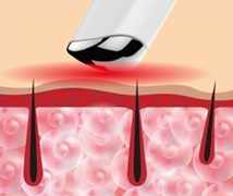 NanoEye EyeMagic crveno LED svjetlo